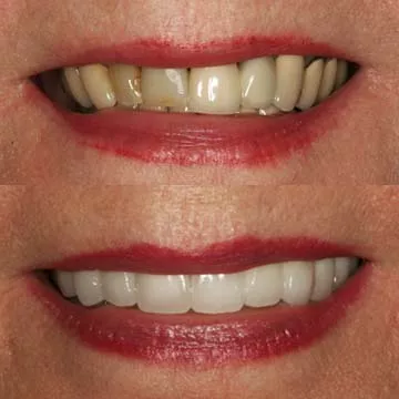 Paul M. Holliday, DDS, HollidaySmiles Dentistry